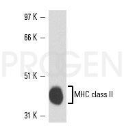 anti-MHC II (mouse) (I-A region) rat monoclonal, IBL-5/22, purified