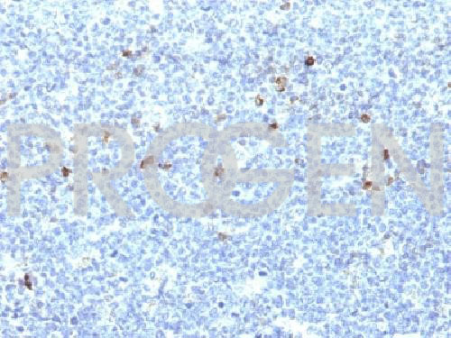 anti-MHC I Aw32+A25 mouse monoclonal, CATA-1, purified