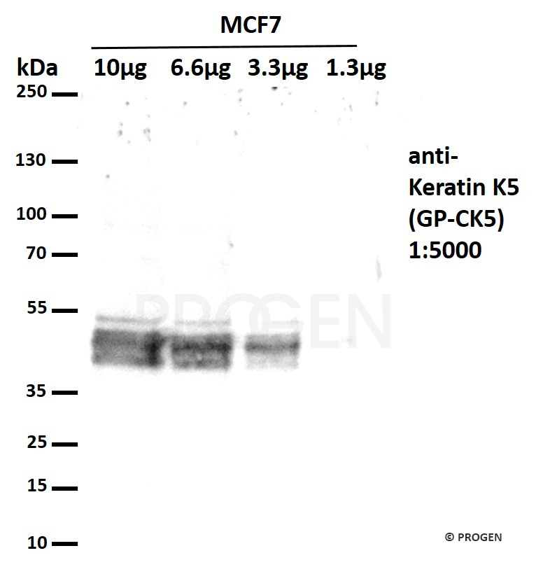 Positive western blot control: anti-Keratin K5 antibody