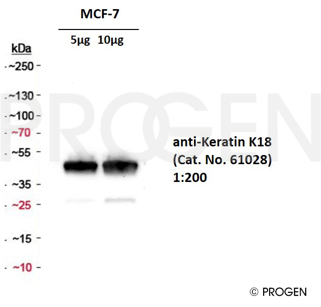 anti-Keratin K18 mouse monoclonal, Ks18.04, lyophilized, purified