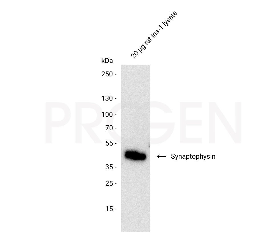 anti-Synaptophysin mouse monoclonal, SY38, liquid, purified, sample