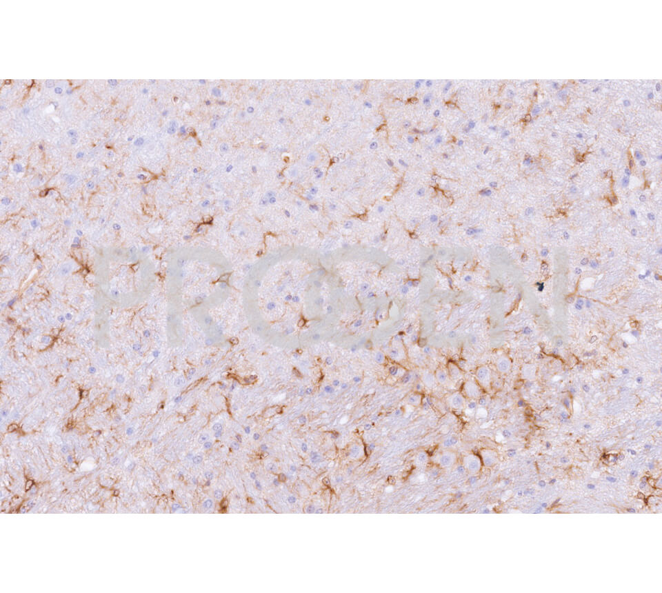 anti-Glial Fibrillary Acidic Protein mouse monoclonal, GF 12.24, lyophilized, purified