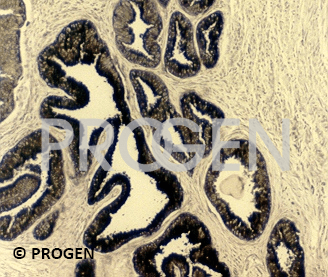 anti-Prostate-Specific Antigen mouse monoclonal, ER-PR8, ascites fluid