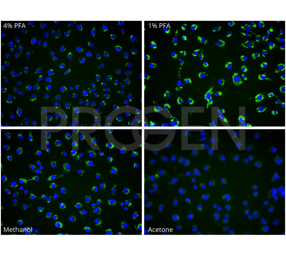 anti-Yersinia enterocolitica O:9 mouse monoclonal, 8E9, FITC Conjugate 