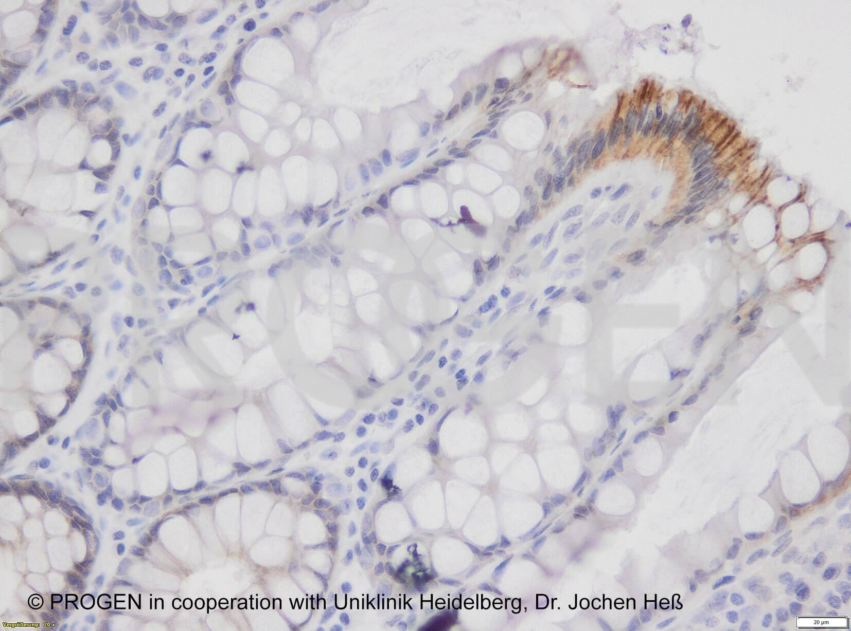 anti-Desmoglein 2 mouse monoclonal, G129, supernatant