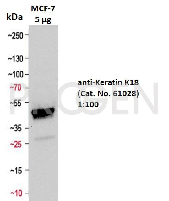 Positive western blot control: anti-Keratin K18 antibody