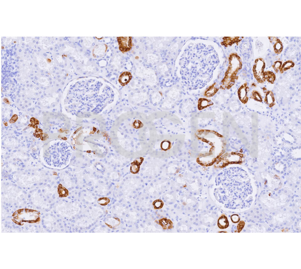 anti-Keratin K19 mouse monoclonal, Ks19.1 (A53-B/A2), lyophilized, purified