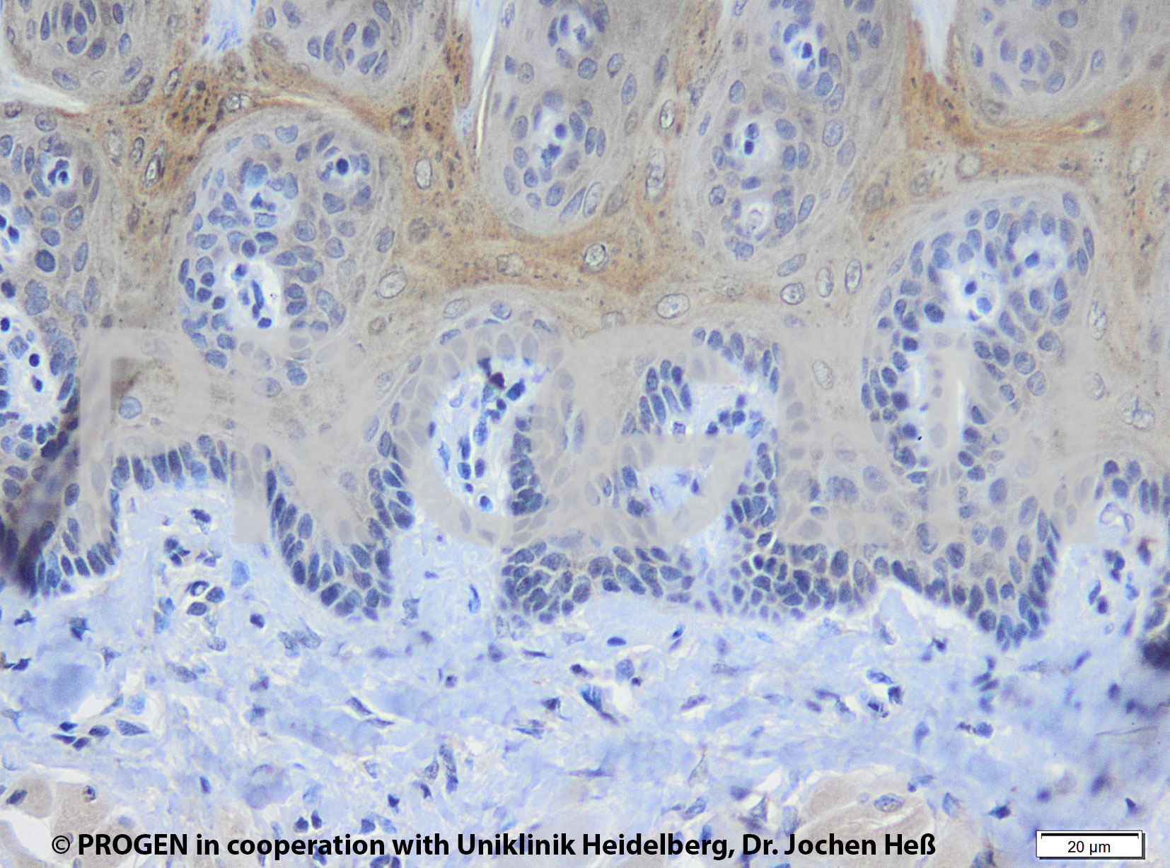 anti-Keratin Pan mouse monoclonal, Lu-5, lyophilized, purified