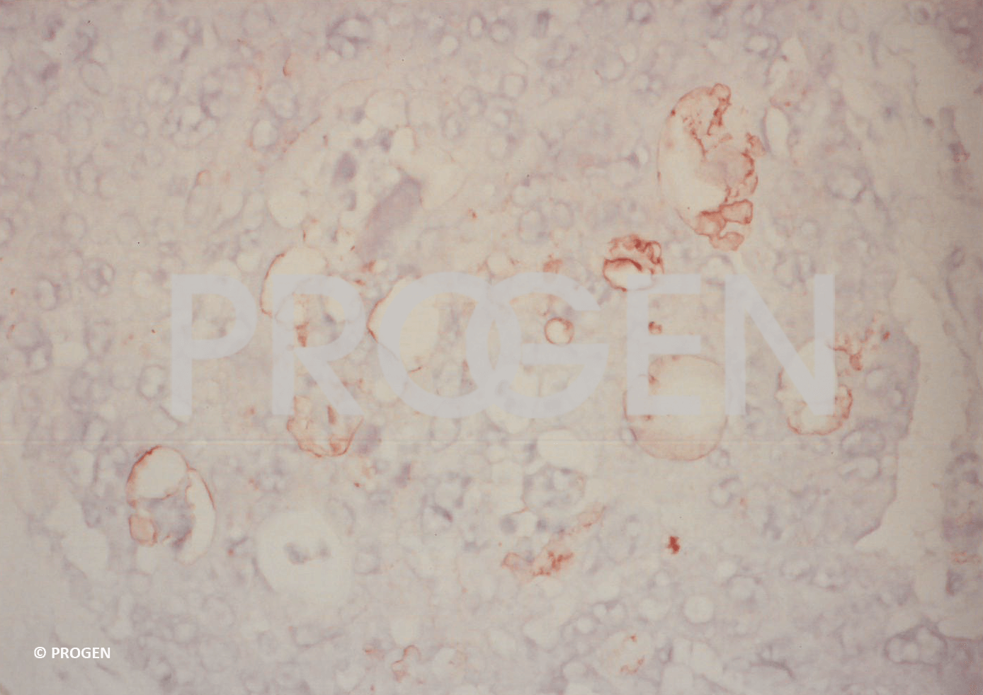 anti-Carcinoembryonic Antigen mouse monoclonal, PARLAM4, ascites fluid