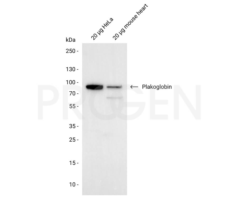 anti-Plakoglobin (N-terminus) guinea pig polyclonal, serum