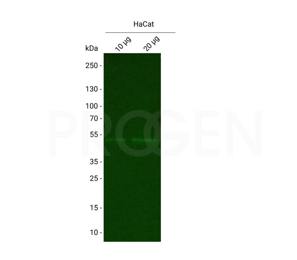 anti-Keratin K18 mouse monoclonal, Ks18.04, FITC Conjugate 