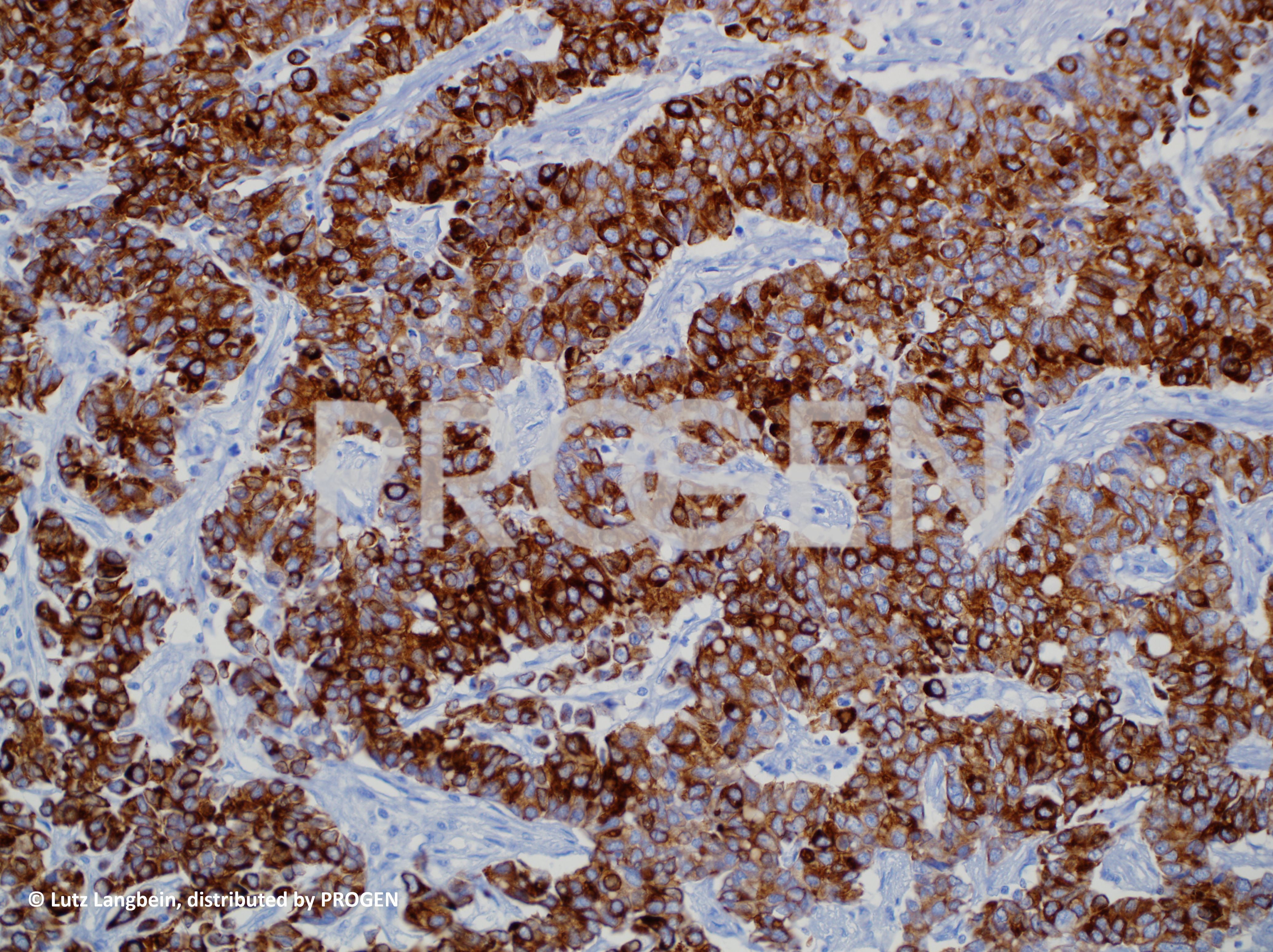 anti-Keratin K20 mouse monoclonal, IT-Ks20.8, lyophilized, purified
