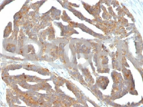 anti-GnRH-receptor mouse monoclonal, F1G4, purified