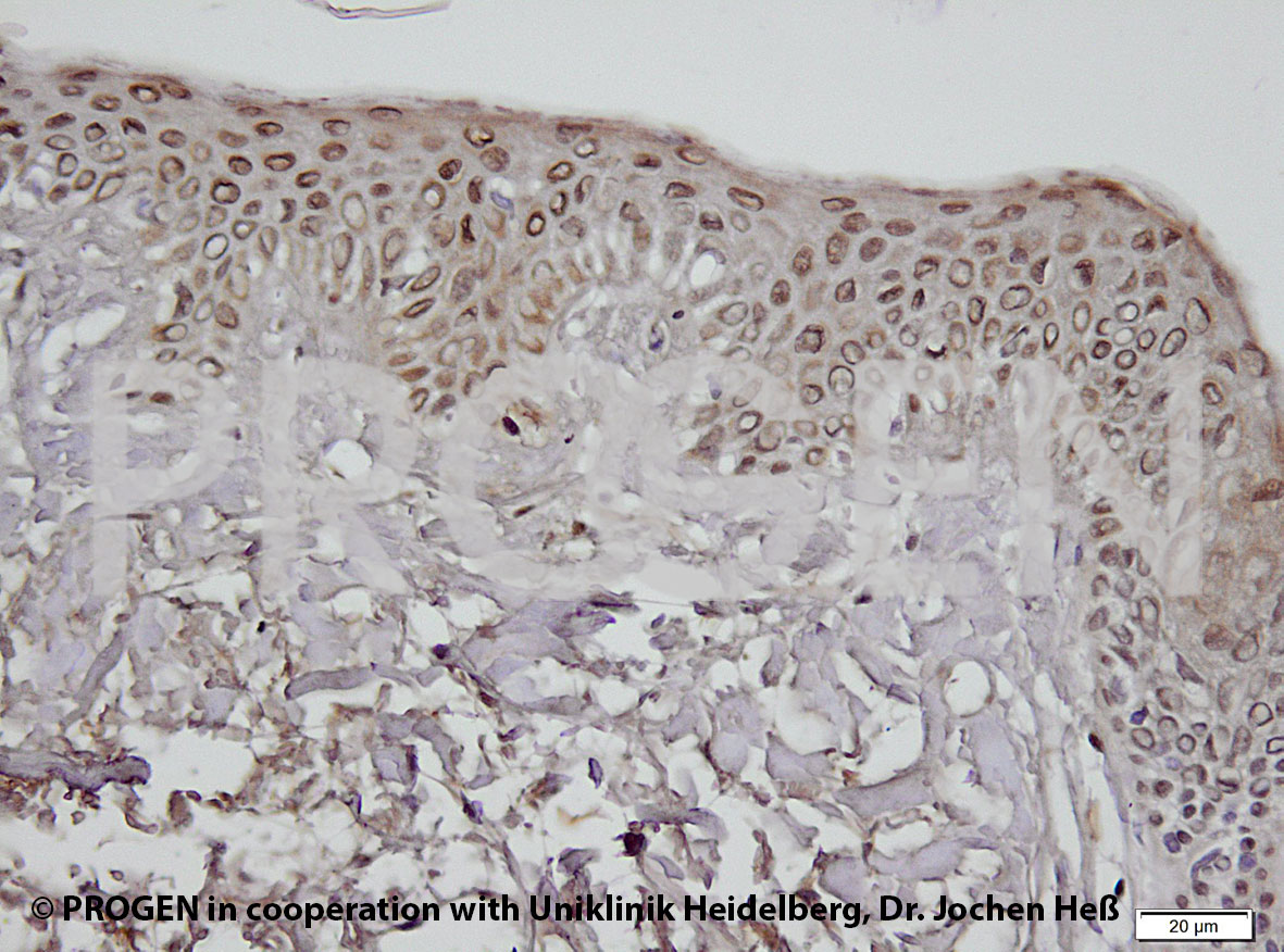 anti-Perilipin 2 (mouse N-terminus) guinea pig polyclonal, serum