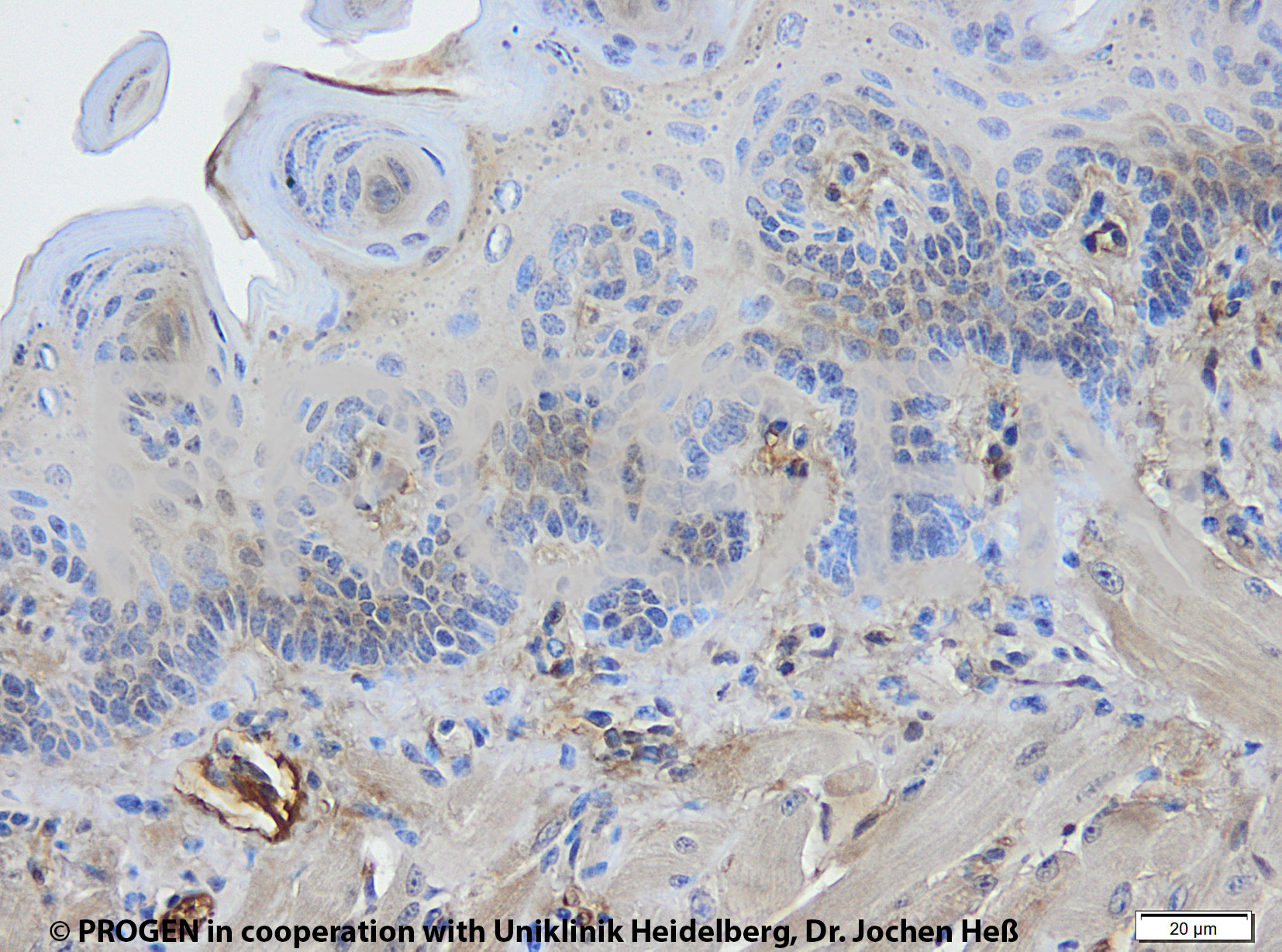 anti-Keratin Pan mouse monoclonal, Lu-5, lyophilized, purified