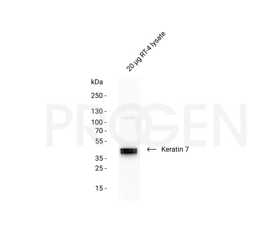 anti-Keratin K7 mouse monoclonal, Ks7.18, liquid, purified, sample