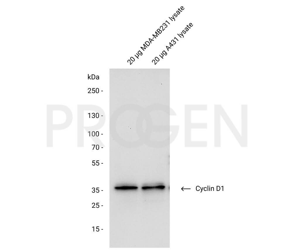 anti-Cyclin D1 mouse monoclonal, DCS-6, lyophilized, purified