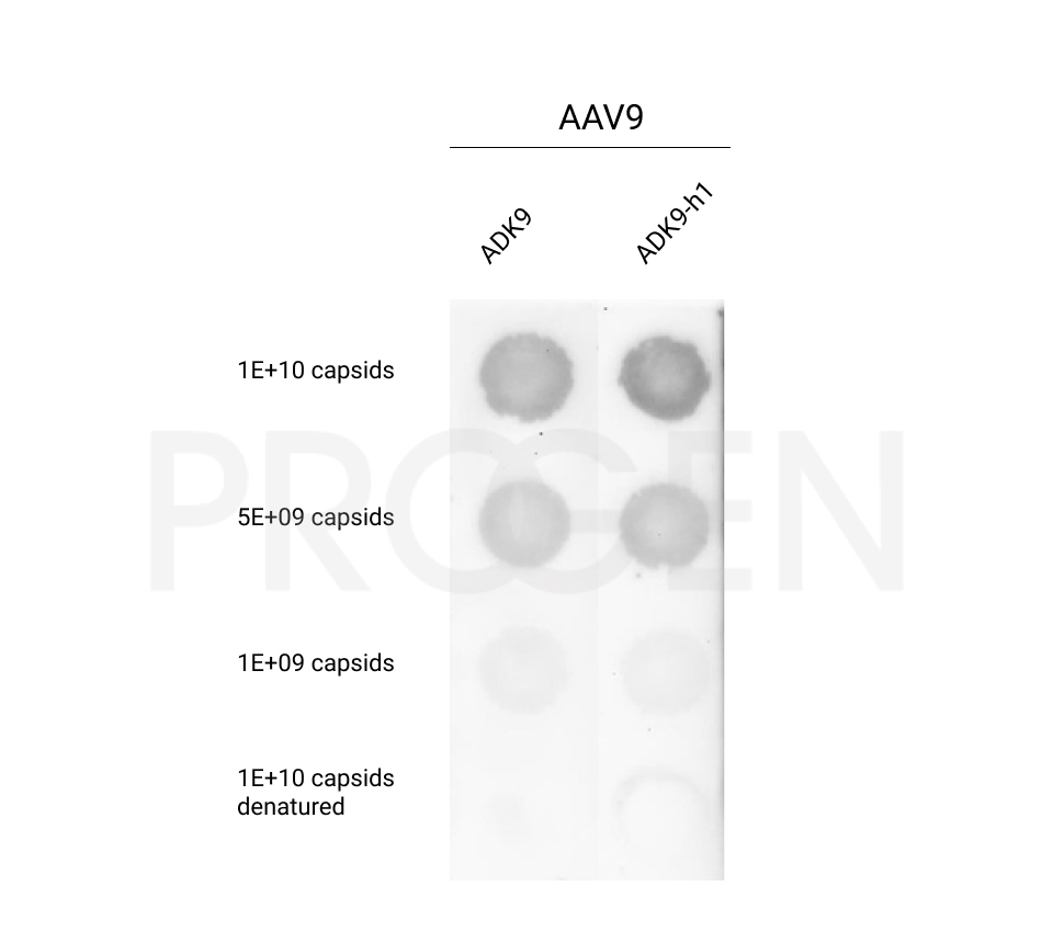 anti-AAV9, human chimeric, ADK9-h1