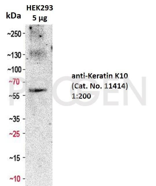 anti-Keratin K10 mouse monoclonal, DE-K10, supernatant