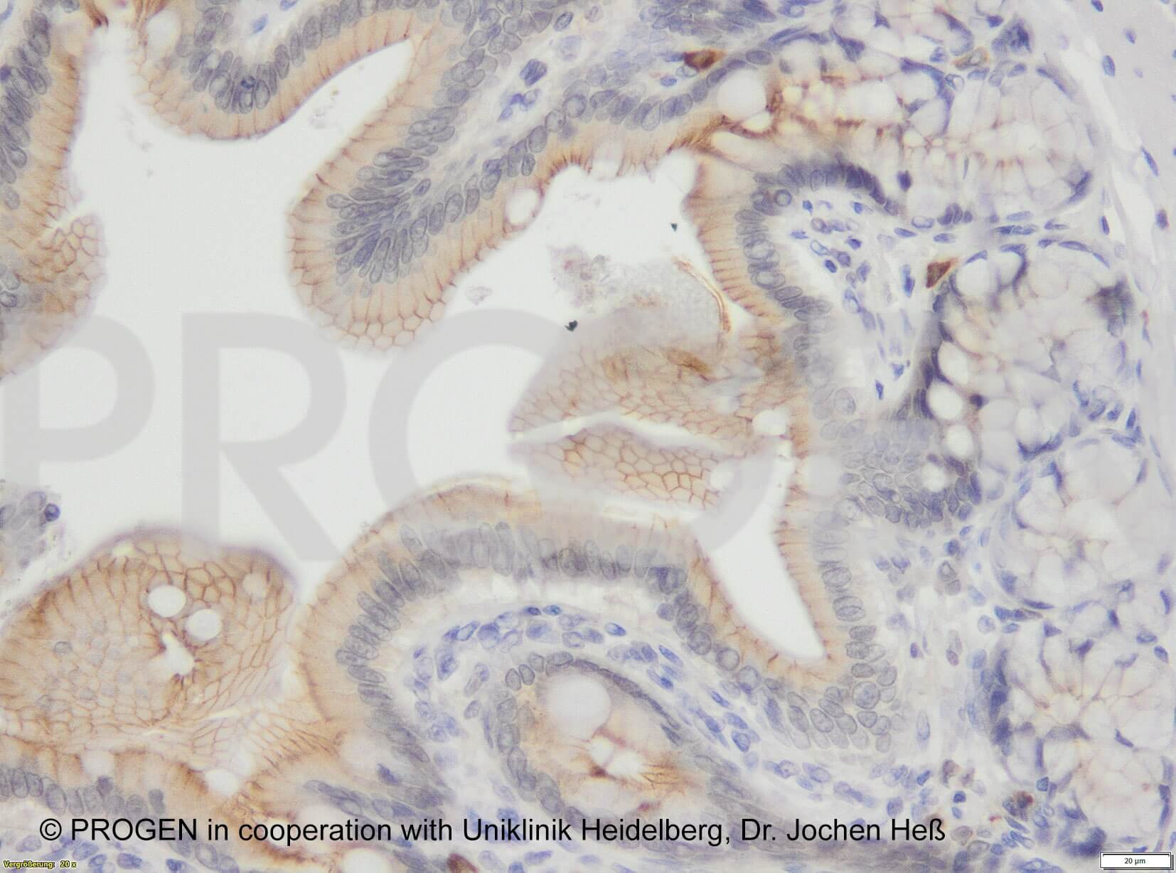 anti-Desmoglein 2 mouse monoclonal, G129, supernatant