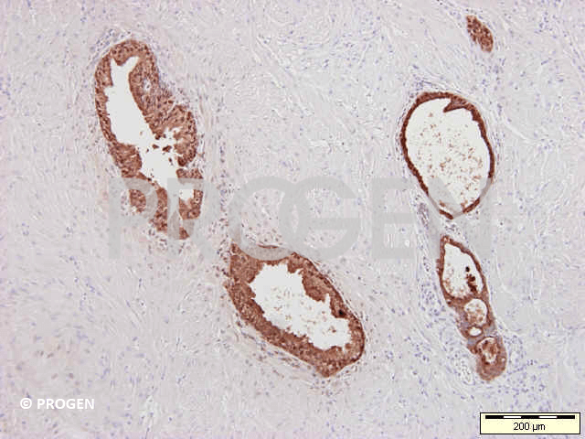 anti-Prostate-Specific Antigen mouse monoclonal, ER-PR8, ascites fluid