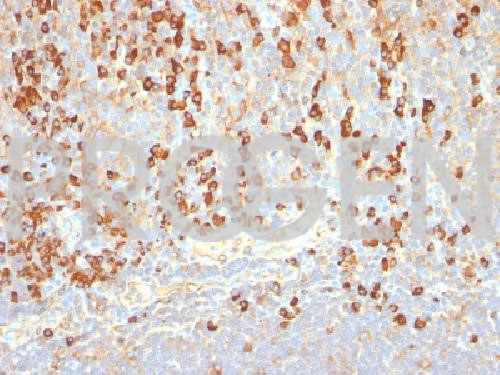anti-Plasma Cell Marker mouse monoclonal, EBS-O-231, purified