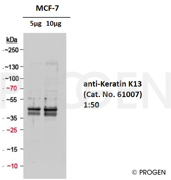 anti-Keratin K13 mouse monoclonal, Ks13.1, lyophilized, purified