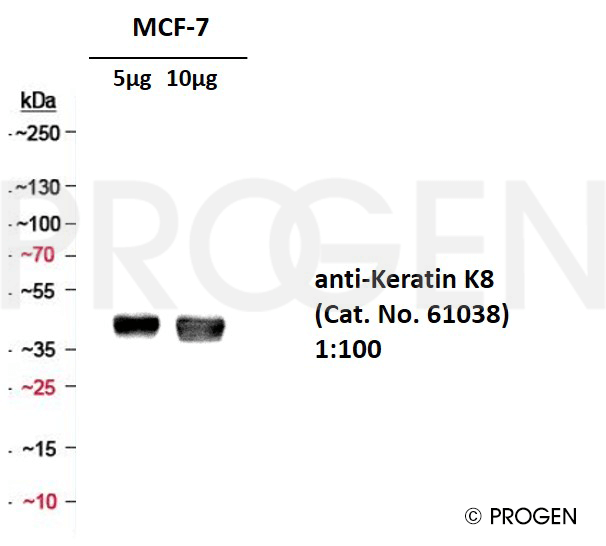 Positive western blot control: anti-Keratin K8 antibody
