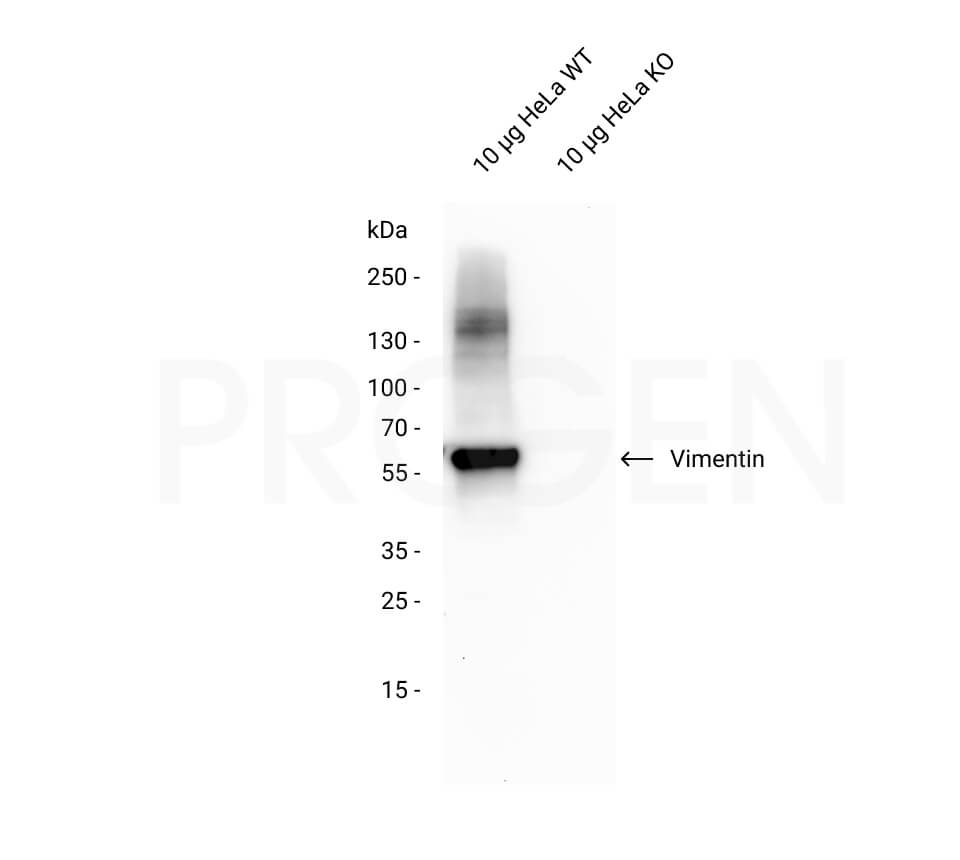 anti-Vimentin (N-terminus) guinea pig polyclonal, serum